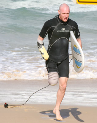 Paul de Gelder, shark victim, surfer and amputee